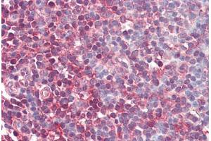 Human Tonsil (formalin-fixed, paraffin-embedded) stained with MAP2K1 antibody ABIN461964 at 10 ug/ml followed by biotinylated goat anti-rabbit IgG secondary antibody ABIN481713, alkaline phosphatase-streptavidin and chromogen.