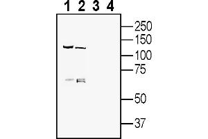 Western blot analysis of mouse brain lysate (lanes 1 and 3) and rat brain lysate (lanes 2 and 4):1-2.