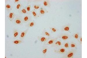 Immunocytochemistry analysis of ABIN7127699 diluted at 1:80 and staining in Hela cells performed on a Leica BondTM system.