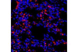 Immunofluorescence of paraffin embedded mouse lung using AMIGO2 (ABIN7072966) at dilution of 1: 1300 (400x lens)