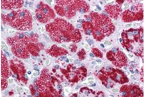 Human Adrenal: Formalin-Fixed, Paraffin-Embedded (FFPE) (ADRP anticorps  (AA 28-281))