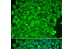 Immunofluorescence analysis of HeLa cells using SGCE Polyclonal Antibody (SGCE anticorps)
