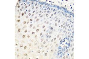 Immunohistochemistry of paraffin-embedded human esophagus using HNRNPA0 antibody.