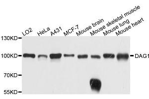 Western blot analysis of extracts of various cell lines, using DAG1 antibody. (Dystroglycan anticorps  (AA 654-749))
