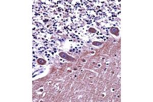 A1 Antibody (C-term) ((ABIN657826 and ABIN2846793))immunohistochemistry analysis in formalin fixed and paraffin embedded human cerebellum tissue followed by peroxidase conjugation of the secondary antibody and DAB staining. (alpha Adaptin anticorps  (C-Term))