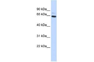 WB Suggested Anti-ZNF74 Antibody Titration:  0. (ZNF74 anticorps  (Middle Region))