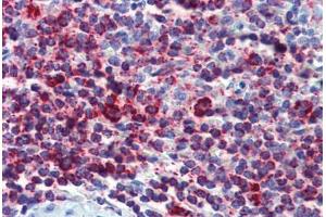 Human Spleen (formalin-fixed, paraffin-embedded) stained with HSPD1 antibody ABIN462364 followed by biotinylated anti-mouse IgG secondary antibody ABIN481714, alkaline phosphatase-streptavidin and chromogen.