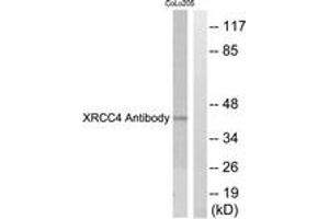 Western blot analysis of extracts from COLO205 cells, using XRCC4 Antibody.