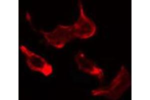 ABIN6274690 staining HuvEc cells by IF/ICC.