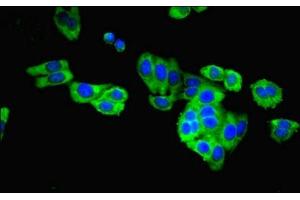 Immunofluorescent analysis of HepG2 cells using ABIN7146964 at dilution of 1:100 and Alexa Fluor 488-congugated AffiniPure Goat Anti-Rabbit IgG(H+L)