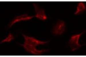 ABIN6266453 staining Hela by IF/ICC. (MAPK15 anticorps  (pThr175, pTyr177))