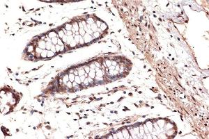 Immunohistochemistry of paraffin-embedded human colon using DDX17 Rabbit mAb (ABIN7266688) at dilution of 1:100 (40x lens).