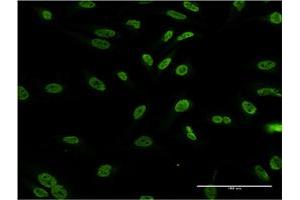 Immunofluorescence of monoclonal antibody to DLX1 on HeLa cell. (DLX1 anticorps  (AA 152-255))