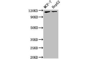 Western Blot Positive WB detected in: MCF-7 whole cell lysate, HepG2 whole cell lysate All lanes: ATP9A antibody at 3. (ATP9A anticorps  (AA 2-69))