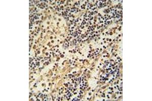 Immunohistochemistry analysis in formalin fixed and paraffin embedded human lymph node reacted with HEMK1 Antibody (C-term) followed  which was peroxidase-conjugated to the secondary antibody, followed by DAB staining. (HEMK1 anticorps  (C-Term))