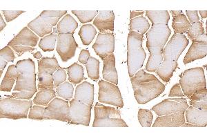 Detection of MMP2 in Human Skeletal muscle Tissue using Polyclonal Antibody to Matrix Metalloproteinase 2 (MMP2)