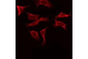 ABIN6273920 staining COS7 by IF/ICC. (FZD10 anticorps)