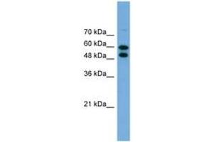 Image no. 1 for anti-Phosphoglucomutase 1 (PGM1) (AA 467-516) antibody (ABIN6746448) (Phosphoglucomutase 1 anticorps  (AA 467-516))