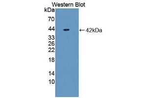 Detection of Recombinant NFkB, Rat using Polyclonal Antibody to Nuclear Factor Kappa B (NFkB)