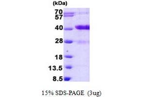 SDS-PAGE (SDS) image for MARCKS-Like 1 (MARCKSL1) (AA 1-195) protein (His tag) (ABIN6387162)