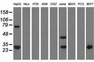 Western blot analysis of extracts (35 µg) from 9 different cell lines by using anti-QPRT monoclonal antibody. (QPRT anticorps)