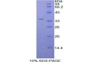 SDS-PAGE analysis of Human Myosin IF Protein. (MYO1F Protéine)