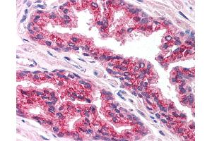 Anti-FOXA1 antibody IHC of human prostate.