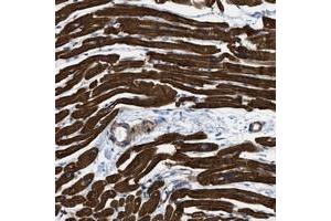 Immunohistochemical staining of human heart muscle with KCNH7 polyclonal antibody  shows strong cytoplasmic positivity in myocytes at 1:1000-1:2500 dilution. (KCNH7 anticorps)