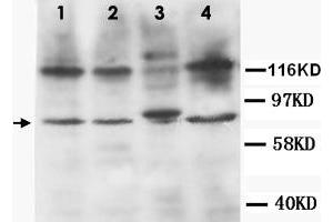 Western Blot analysis of TNFRSF1B expression from cell extracts with TNFRSF1B polyclonal antibody . (TNFRSF1B anticorps  (N-Term))