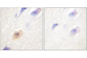 Immunohistochemistry analysis of paraffin-embedded human brain tissue, using CSE1L Antibody.