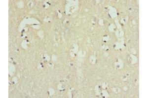 Immunohistochemistry of paraffin-embedded human brain tissue using ABIN7156942 at dilution of 1:100 (IL9 Receptor anticorps  (AA 272-521))