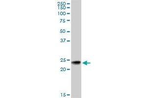 RAB7B monoclonal antibody (M01), clone 3B3. (RAB7B anticorps  (AA 100-199))