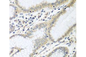 Immunohistochemistry of paraffin-embedded Human stomach using RPN2 Polyclonal Antibody at dilution of 1:100 (40x lens). (Ribophorin II anticorps)