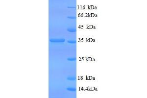 SDS-PAGE (SDS) image for CD59 (CD59) (AA 26-102) protein (GST tag) (ABIN5709239)