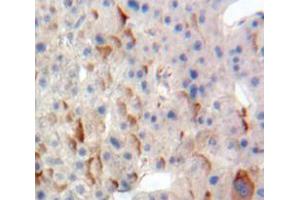 Used in DAB staining on fromalin fixed paraffin-embedded Liver tissue (TPBG anticorps  (AA 32-351))