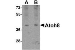 Western blot analysis of ATOH8 in A-20 cell lysate with this product atOH8 antibody at (A) 1 and (B) 2 μg/ml. (ATOH8 anticorps  (C-Term))
