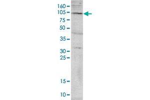 Western blot was performed on nuclear extracts from HeLa cells (HeLa NE, 40 ug) with PADI4 polyclonal antibody , diluted 1 : 1,000 in TBS-Tween containing 5% skimmed milk. (PAD4 anticorps)