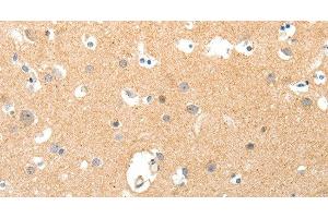 Immunohistochemistry of paraffin-embedded Human brain tissue using TNXB Polyclonal Antibody at dilution 1:40 (TNXB anticorps)