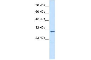 WB Suggested Anti-CLIC2 Antibody Titration:  1. (CLIC2 anticorps  (Middle Region))