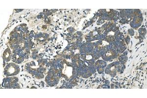 IHC analysis of CDC123 using anti-CDC123 antibody (ABIN7599284). (CDC123 anticorps  (AA 1-336))