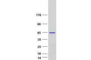 Validation with Western Blot