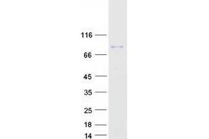 Validation with Western Blot