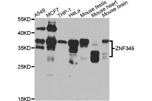 Western blot analysis of extracts of various cell lines, using ZNF346 antibody (ABIN5975303) at 1/1000 dilution. (ZNF346 anticorps)
