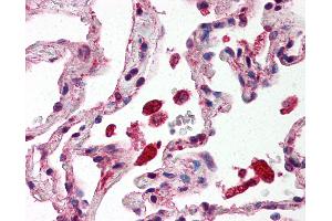 Anti-STAT1 antibody IHC of human lung, alveolar macrophages. (STAT1 anticorps  (C-Term))