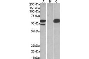 HEK293 lysate (10 µg protein in RIPA buffer) overexpressing Human TRIM21 with C-terminal MYC tag probed with AP22453PU-N TRIM21 antibody (1 µg/ml) in Lane A and probed with anti-MYC Tag (1/1000) in Lane C. (TRIM21 anticorps  (C-Term))