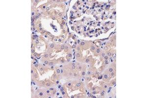 (ABIN6243119 and ABIN6578706) staining COPS7B in human kidney tissue sections by Immunohistochemistry (IHC-P - paraformaldehyde-fixed, paraffin-embedded sections).