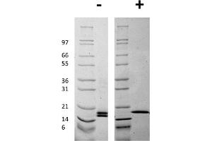 SDS-PAGE of Human Mouse Fibroblast Growth Factor basic Recombinant Protein SDS-PAGE of Mouse Fibroblast Growth Factor basic Recombinant Protein. (FGF2 Protéine)