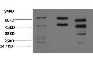 Western Blotting (WB) image for anti-Phosphoserine (Phosphospecific) antibody (ABIN5962159) (Phosphoserine anticorps  (Phosphospecific))