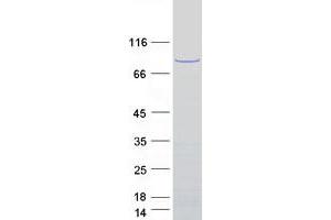 Validation with Western Blot