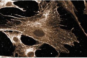 Immunofluorescent staining of human fibroblast cells. (RAC1 anticorps)